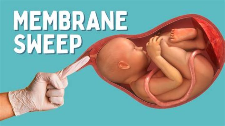 Can you have a sweep at 38 weeks?
