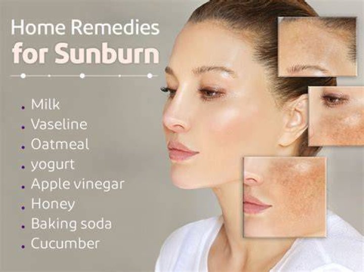 Does sorbolene cream help with sunburn?
