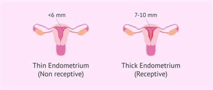 Does thickened endometrium mean pregnancy?