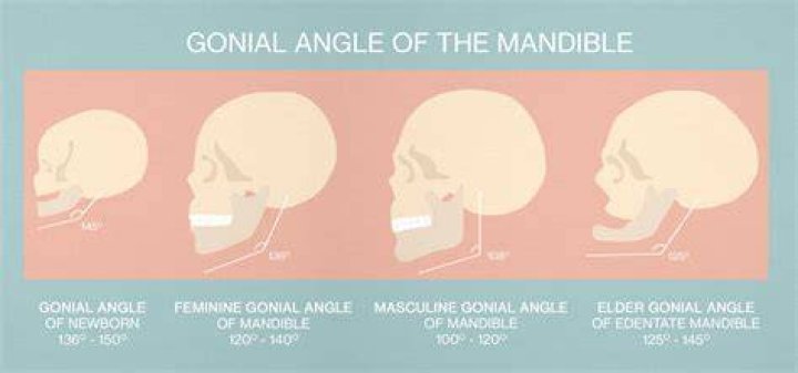How to increase gonial angle?