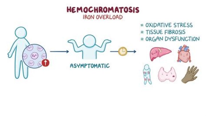 Is hemochromatosis a hematologic disease?