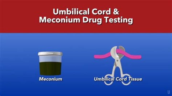 Is meconium drug testing mandatory in texas?