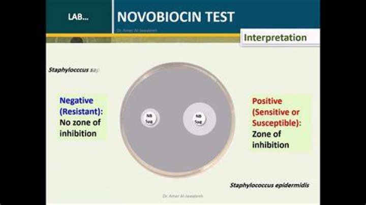 Which microbes) are sensitive to novobiocin?