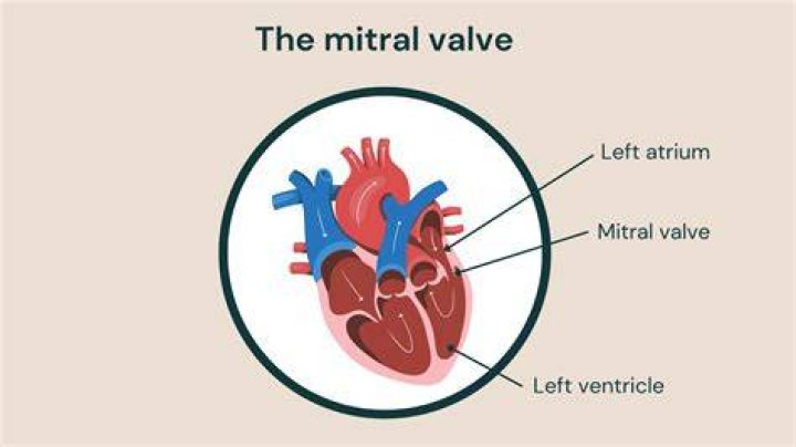 Who is a mitral valve?